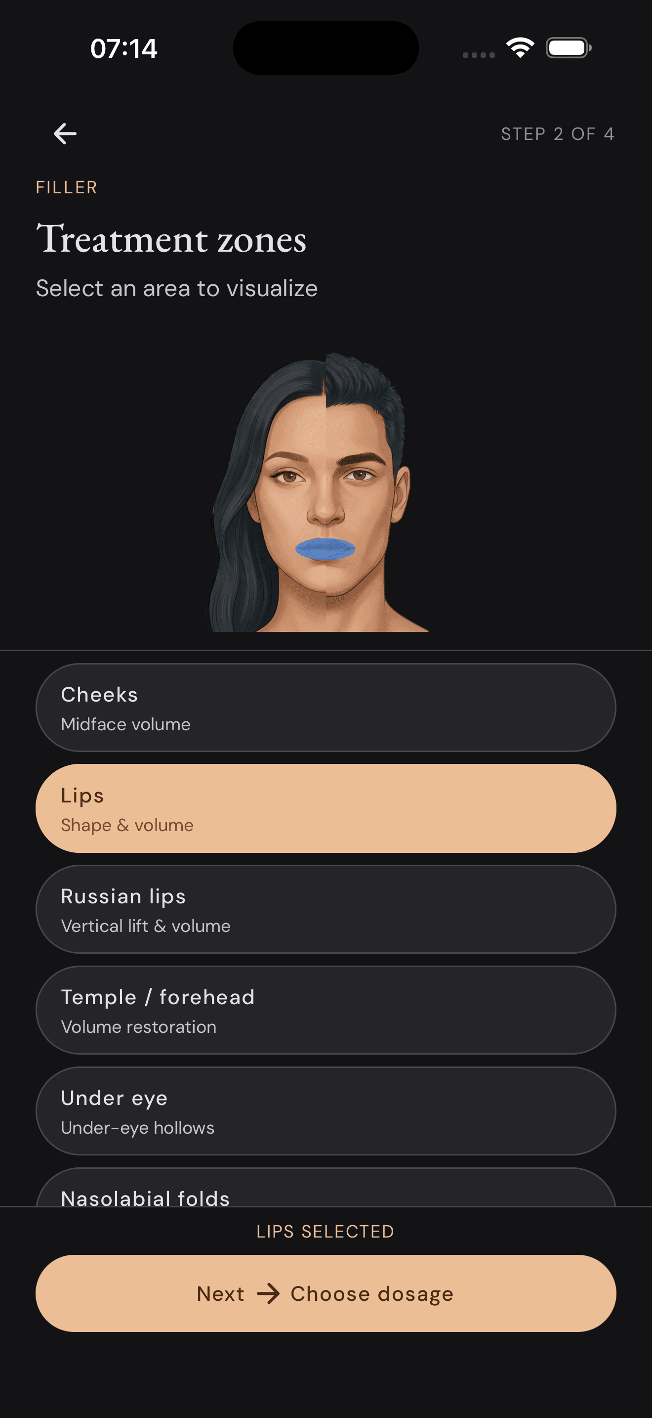 App screenshot: Zone selection screen (step 3)