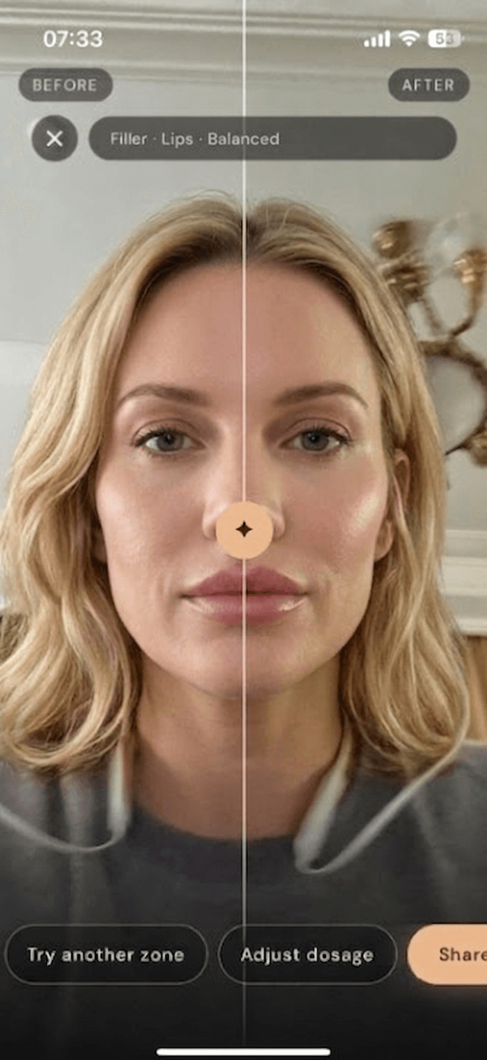 App screenshot: Before / after result screen (step 5)