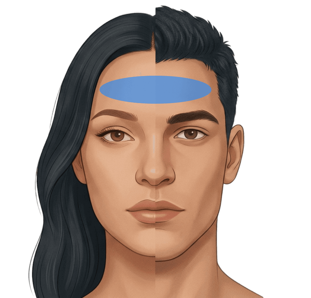 Forehead Lines Botox treatment zone