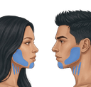 Nefertiti + Chin + Masseter zone diagram