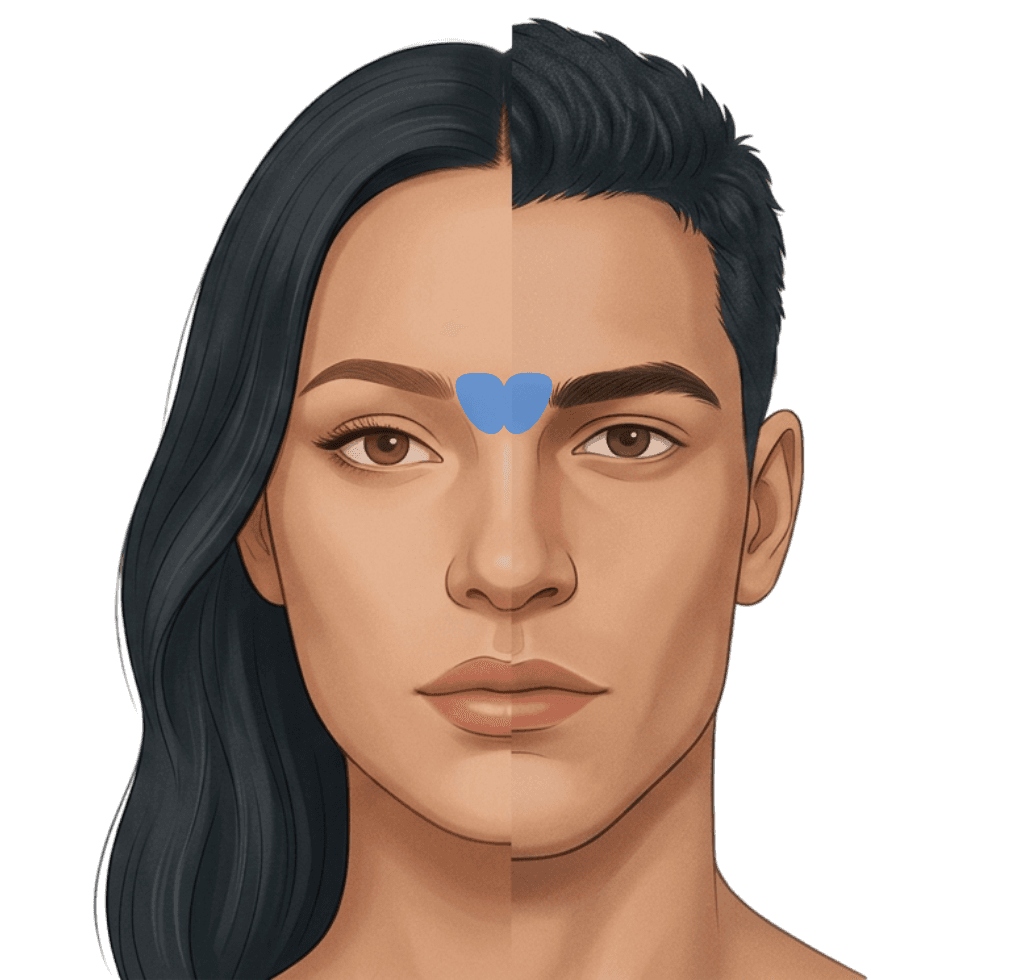 Procerus & Glabella (11 Lines) treatment zone